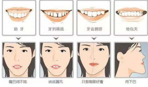 嘴突*后缩，单纯整牙是否有效？治疗方法和怎么样如何？